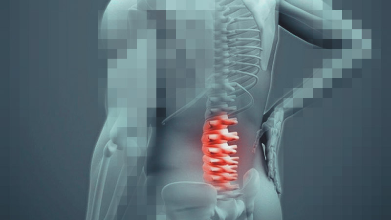 ozonoterapia
